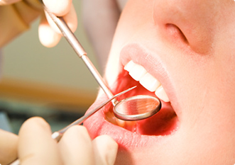矯正専門医と一般歯科の矯正治療の違いについて